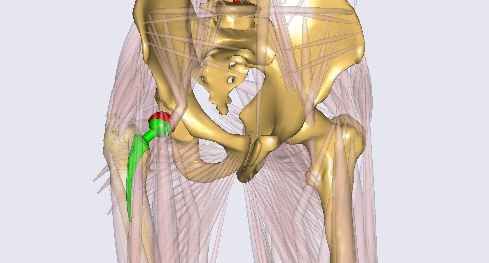 Enlarged view: Hip Model