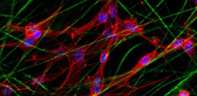 Enlarged view: Confocal microscopy image of chondrocytes within the electrospun fibre network. Blue: cell nucleus; red: cytoskeleton of the cell; green: Polymer fibres.